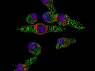 lots of fake epithelial cells.jpg